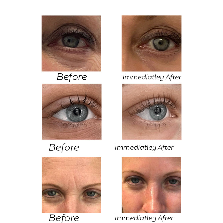 NordicGlow - Eye Elexir