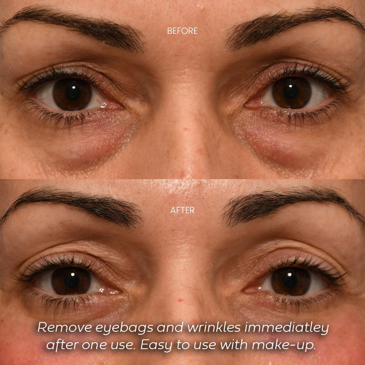 NordicGlow - Eye Elexir