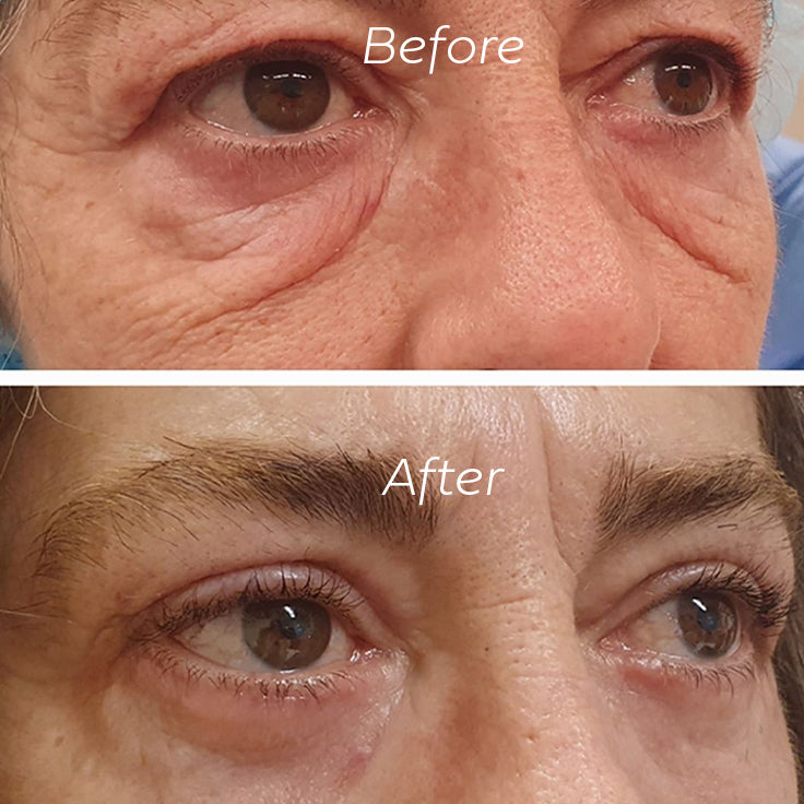 NordicGlow - Eye Elexir